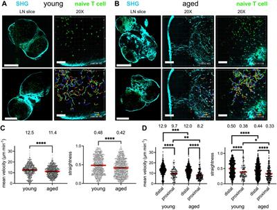 Age-Associated Changes to Lymph Node Fibroblastic Reticular Cells